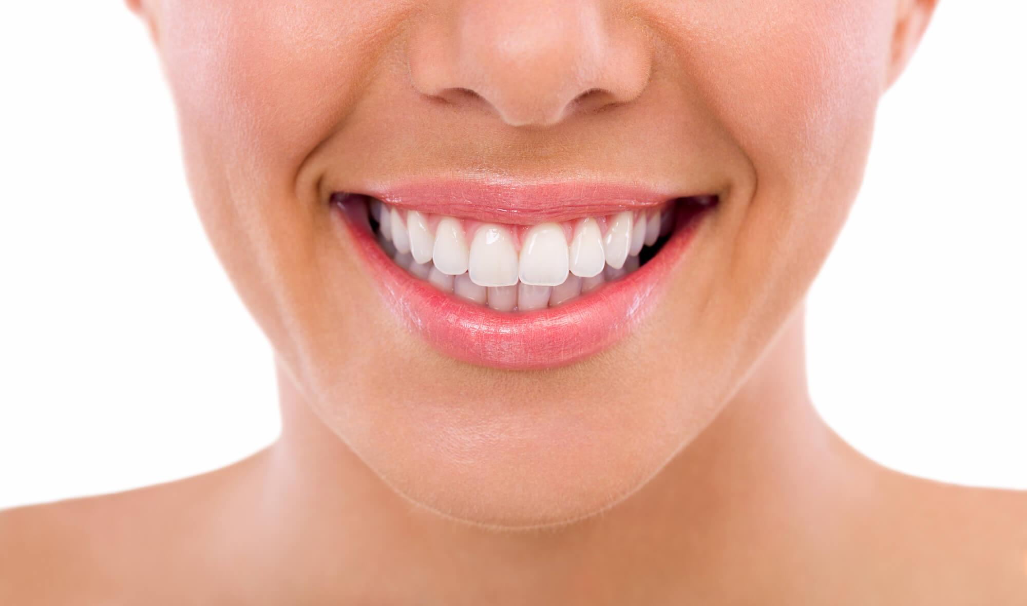 5 effectieve manieren om je tanden te verbeteren en je glimlach te laten stralen