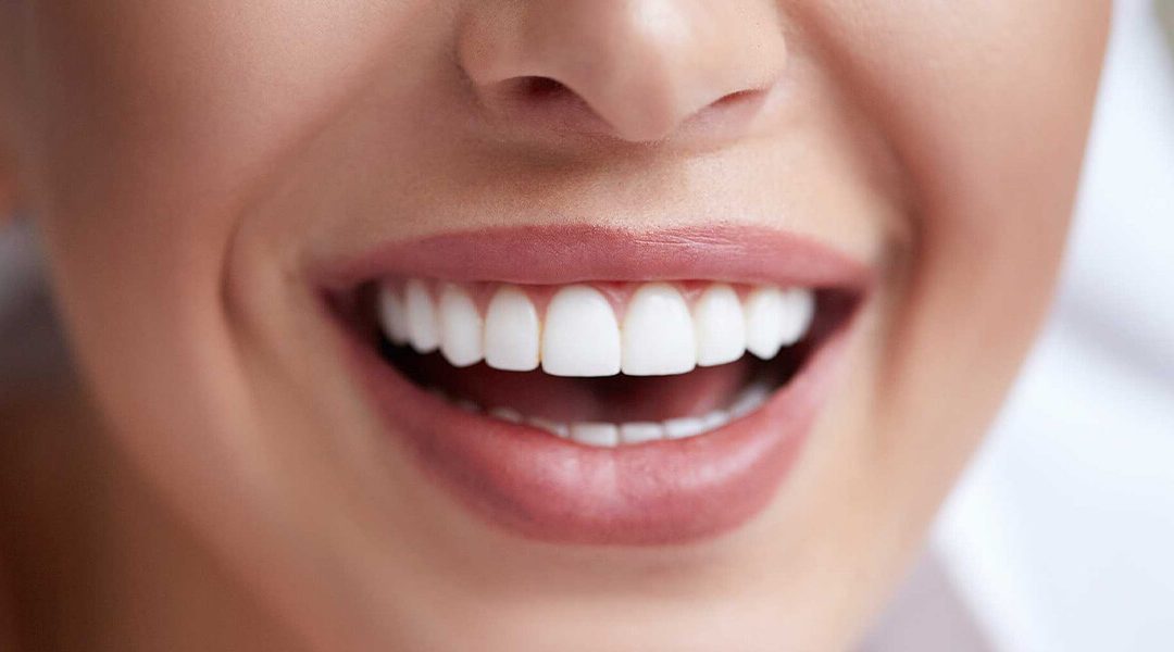 5 effectieve manieren om je tanden te verbeteren en je glimlach te laten stralen