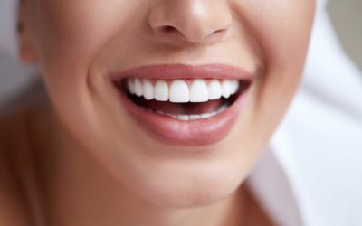 Esthetische tandheelkunde: het geheim voor een stralende glimlach